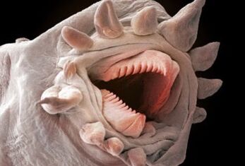 jakie robaki mogą żyć w organizmie człowieka